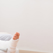 man with leg cast on the phone